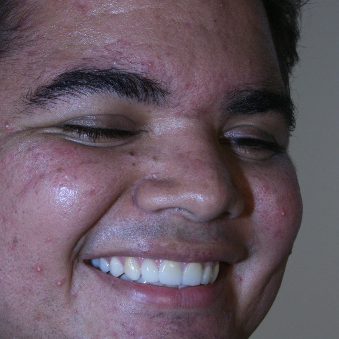 imagem para LP 1080 x 1080 (22)